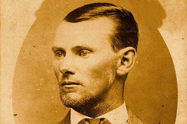 From what malady did Jesse James suffer?